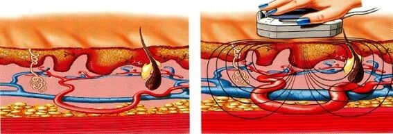 ако краката ви изтръпнат